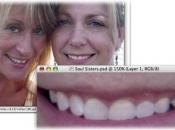 How to whiten teeth