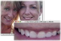 How to whiten teeth